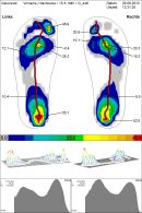 Fußdruckmessung (Bild: Christian Friedrich)