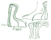 Christian Friedrich - Orthopädische Maßschuhe - Die Peronaeuskappe